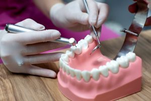 Implante Dentário: Um Sorriso Confiante e Saudável para Você!